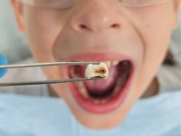 Best Pediatric Emergency Dentist in Ironton, MO